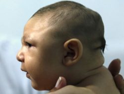 Timoroan Ida Kona Vírus Zinko, Chikungunya 183